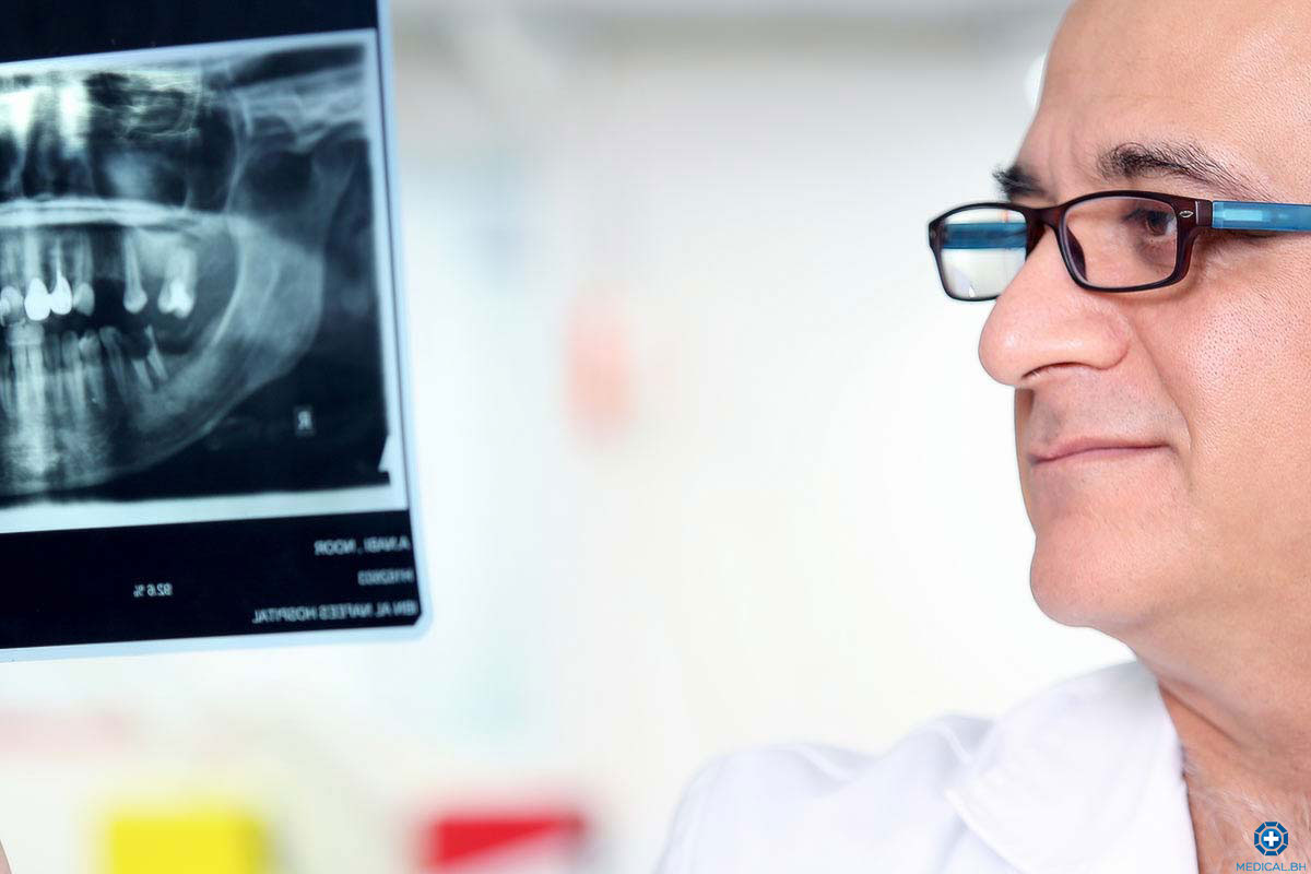 X ray