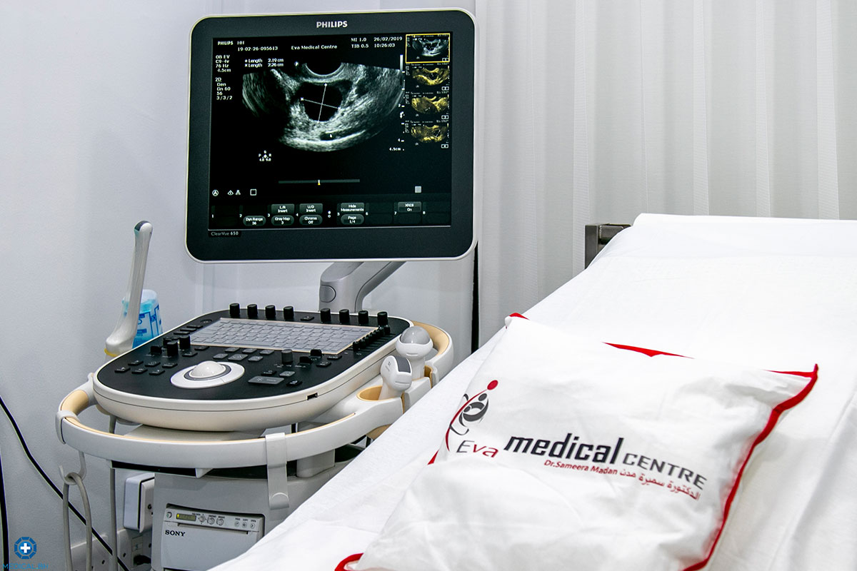 ultrasound 